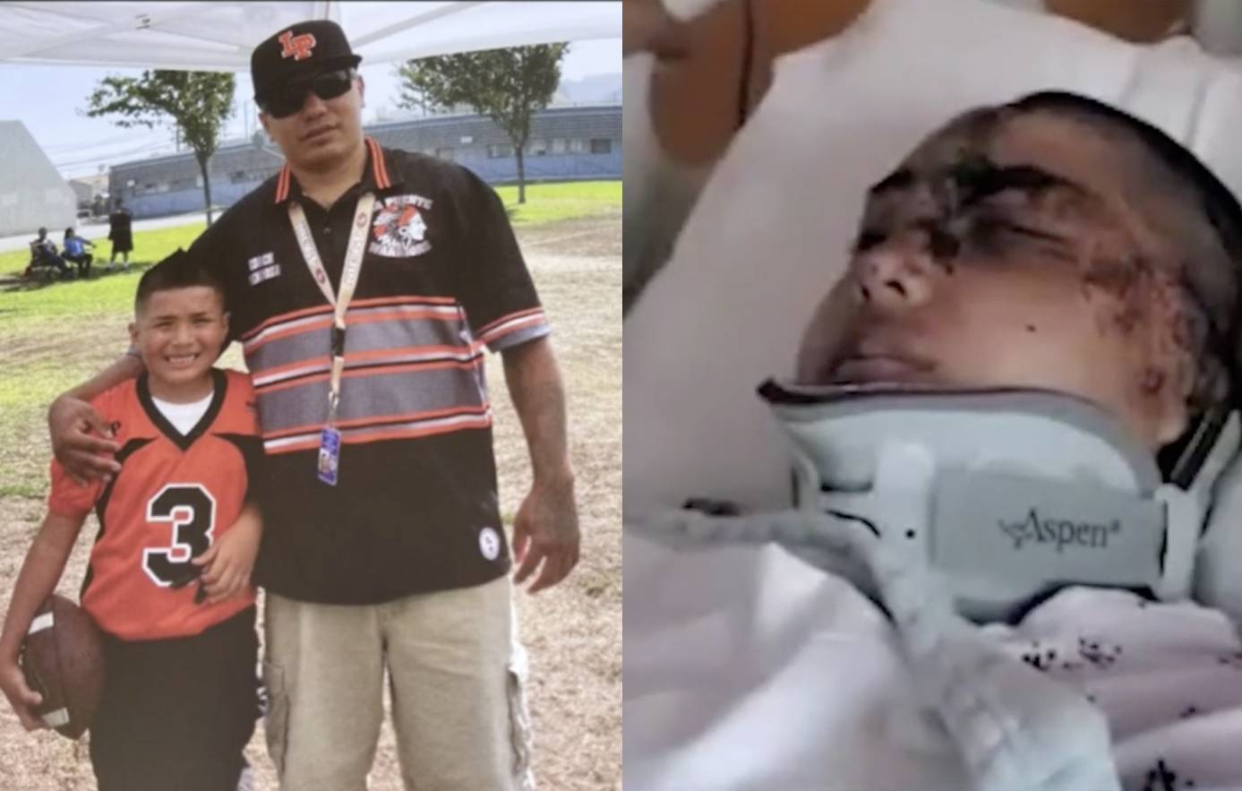 Matthew Mendoza comienza a recodar lo que pasó tras presunto caso de ira al volante en Los Ángeles | Univision 34 Los Angeles KMEX - Vimarsana News